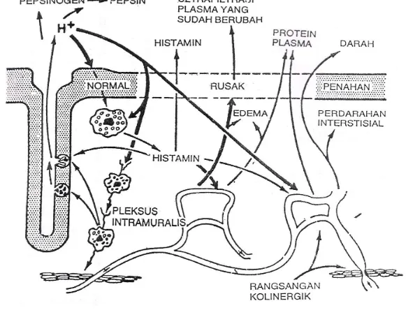 Gambar 1.4. Patofisiologi akibat terjadinya difusi balik asam melalui barrier mukosa lambung yang rusak.