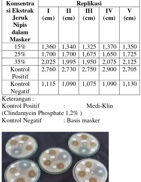 Tabel V. Diameter zona hambat masker gel peel-off ekstrak etanol kulit jeruk manis  