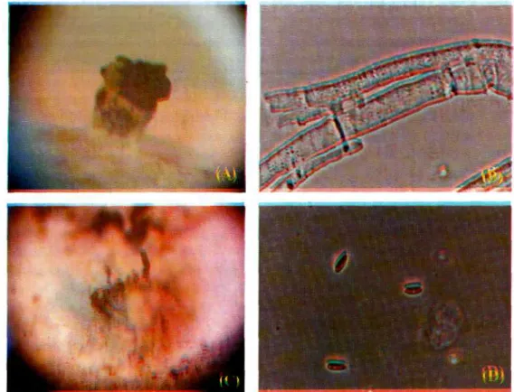 Foto 1. A: Pycnidia dari jamur endofit Diaporthe sp. E yang ditumbuhkan di atas PDA selama 35 hari pada temperatur ruang, (20x)