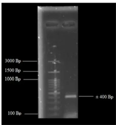 Gambar 2.  Hasil amplifikasi daerah ITS isolat  Ed  1B    dengan  konsentrasi  gel  agarose  1%  dan  Marker  100bp