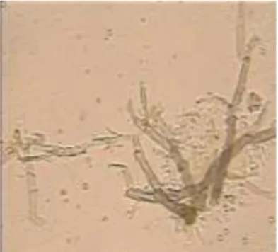 Gambar 3. Hifa dan konidia Rhizoctonia sp. 