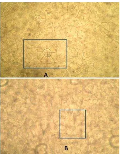 Gambar 2. Trikoma berkelenjar (A) dan epidermis atas dengan palisade (B) (perbesaran 400 x)  