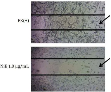 Gambar 4. Contoh aktivitas migrasi sel fibroblas keloid pada 48 jam setelah perlakuan dengan ekstrak N