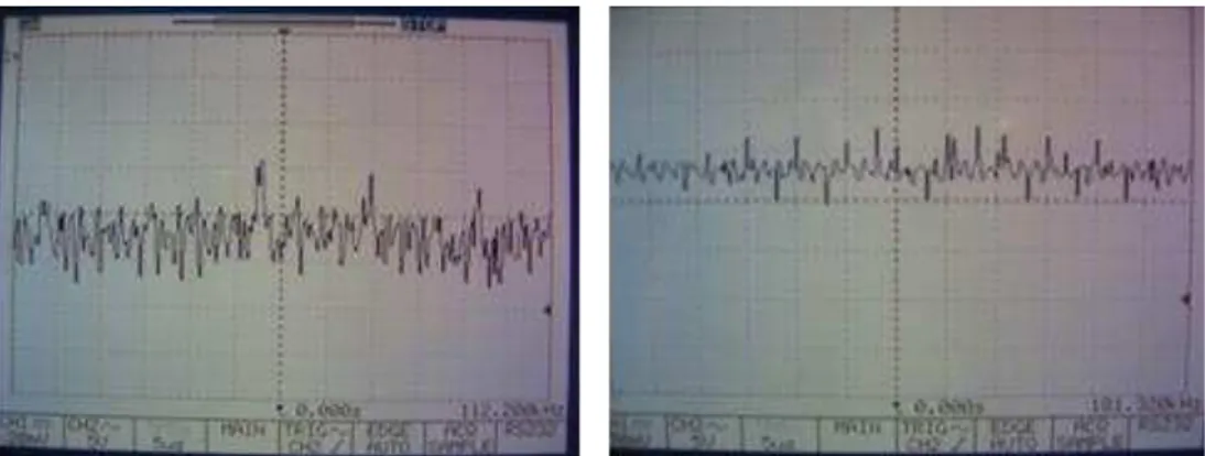 Gambar 5. Sinyal listrik keluaran mikrokontroler dengan bit rate lainnya 