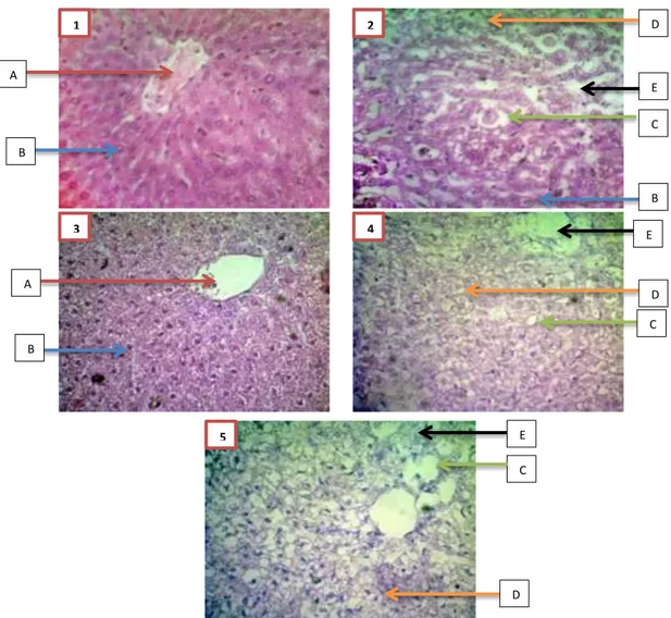 Gambar 3. Gambaran Histopatologi hati tikus : (1) kontrol CMC; (2) Perlakuan sisplatin  5  mg/kgBB  intraperitoneal  dosis  tunggal;  (3)  sisplatin  +  fraksi  n-heksan  dosis  I;  (4)  sisplatin + fraksi n-heksan dosis II; (5) sisplatin + fraksi n-heksan