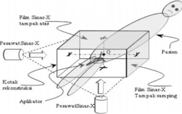 Gambar 2.  Posisi kotak rekonstruksi relatif terhadap pasien dan pesawat sinar-X [2] 