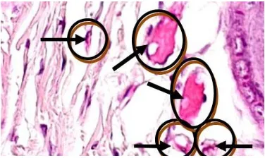 Gambar 1. Tampilan histologi pembuluh darah kapiler yang terbentuk pada kelompok perlakuan ekstrak bunga cengkeh 60 % dengan pengecetan HE (400x)