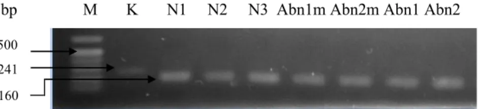 Gambar 1.  Hasil amplifikasi EgACT1. 1 = marker 1 kb; 2 = hasil amplifikasi dengan DNA genom sebagai cetakan (kontrol); 3-9 = hasil  amplifikasi dengan cDNA sampel sebagai cetakan (3 = N1; 4 = N2; 5 = N3; 6 = Abn1m; 7 = Abn2m; 8 = Abn1; 9 = Abn2)
