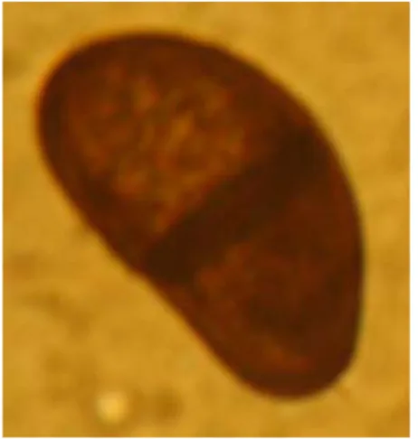 Gambar 2.  Konidia Botryodiplodia theobromae pada tanaman Jeruk. 