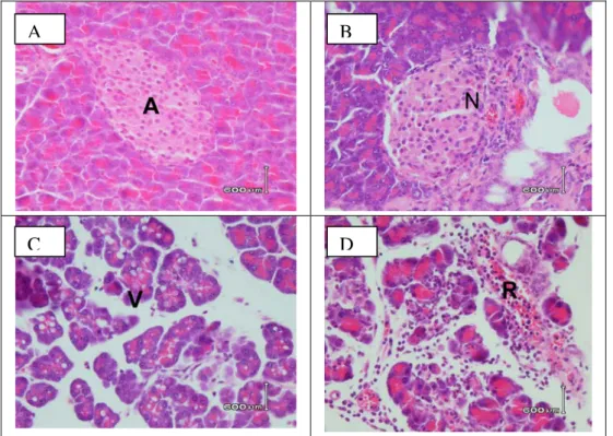 Gambar 3.  A. Gambaran histopatologi organ pankreas yang tidak mengalami perubahan dengan   pengecatan hematoksilin eosin (HE) perbesaran100x, A adalah pulau Langerhans