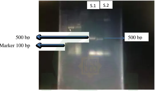 Gambar 4.1. Hasil elektroforesis dari produk amplifikasi gen 1TS 1 dan 1TS 4.  Setelah  melalui  pembacaan  hasil  amplifikasi  menggunakan  UvV  iliminator  yang  kemudian  diamati  hasilnya  lewat  komputer  dapat  dilihat  dari  hasil  elektroforesis  t
