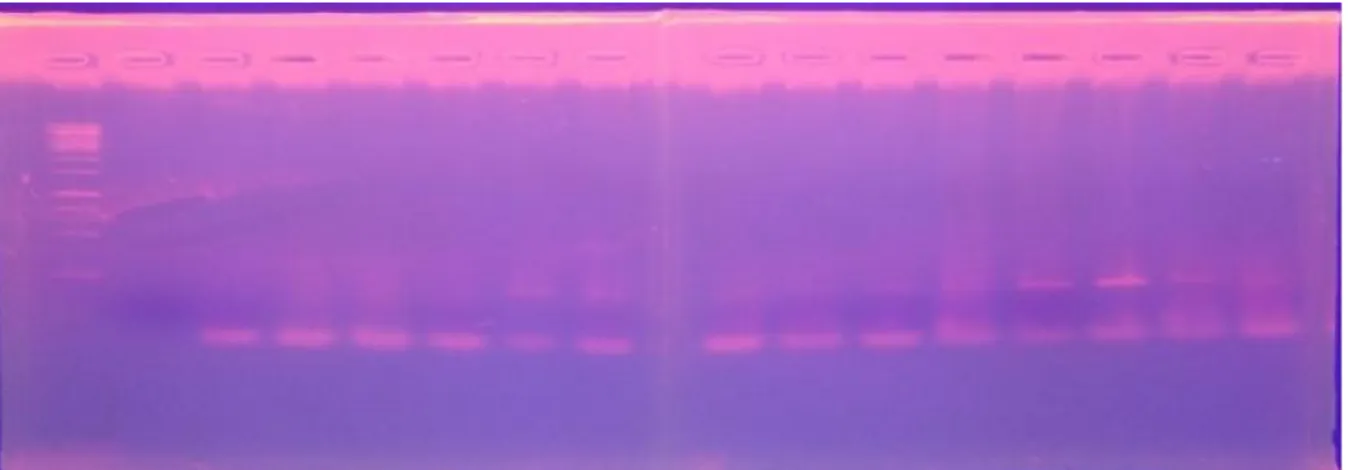 Gambar 1.  Foto elektroforesis embrio hasil PCR, terlihat 2 ban yang menandakan jantan,(Y)  dan  yang  1  ban  betina  (X)