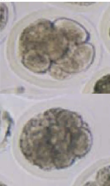 Gambar 2.  Embrio 8-16  Sel 