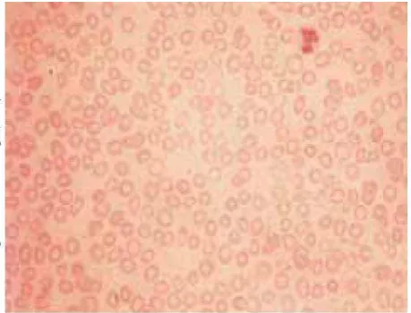 Gambar 2.2 Gambaran sel target  (Krafts, 2009). 