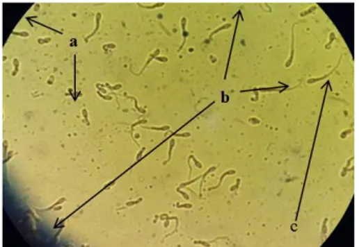 Gambar 1. Abnormalitas primer ekor melingkar  (a); abnormalitas sekunder ekor terputus  (b) dan spermatozoa normal (c)