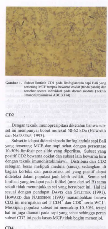 Gambar 1. Subset limfosit CD1 pada limfoglandula sapi Bali yang terserang MCF tampak bewarna coklat (tanda panah) dan tersebar secara individual pada daerah medula (Teknik imunohistokimiawi ABC X174)