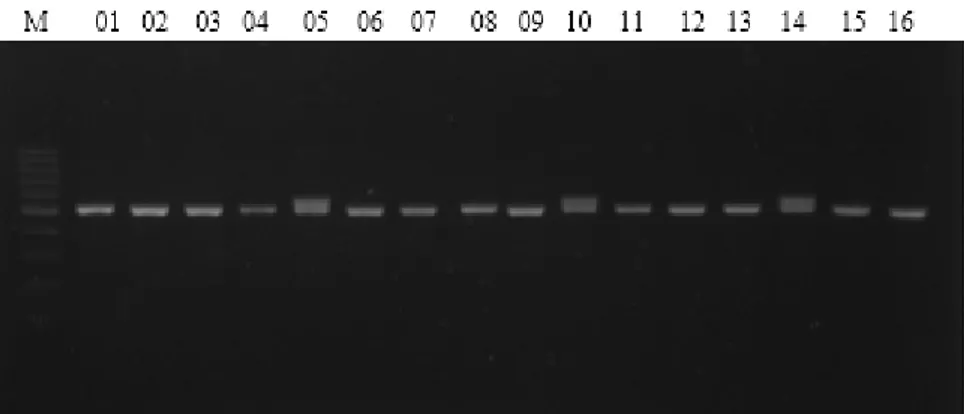 Gambar 1. Visualisasi hasil amplifikasi fragmen gen CD1B dengan menggunakan gel agarosa 1.5%                   (M = marker DNA 100 bp; 01-16 = sampel DNA)