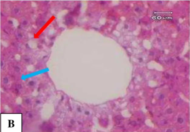 Gambar  4.  Gambaran  mikroskopik  hati  tikus  wistar  kelompok  D.  Tampak  sedikit  regenerasi  sel  hati  (panah  biru),  masih  ada  perlemakan  (panah  merah)  dan  pembengkakan  sel  (panah  hijau)