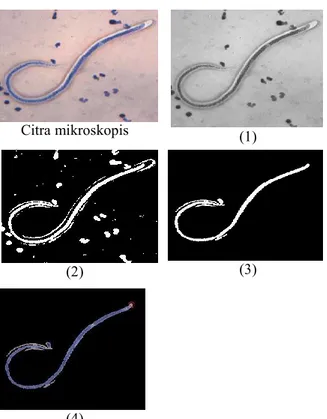 Gambar 3. Tahapan Segmentasi pada Citra  Mikroskopis Brugia malayi. 