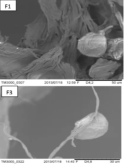 Gambar 4. Morfologi dari mikrosfer ovalbumin-alginat F1 dan F3 dengan menggunakan mikroskop optik perbesaran 400x