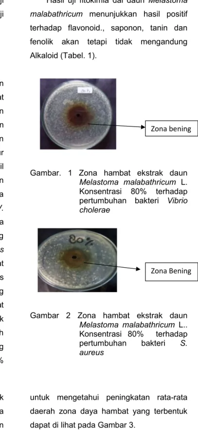Gambar  2  Zona  hambat  ekstrak  daun  Melastoma  malabathricum  L..  Konsentrasi  80%    terhadap  pertumbuhan  bakteri  S