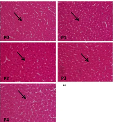 Gambar 2. histopatologi hepatosit hepar tikus Wistar yang mengalami stres fisiologis setelah pemberian pakan  dengan suplementasi daging ikan gabus