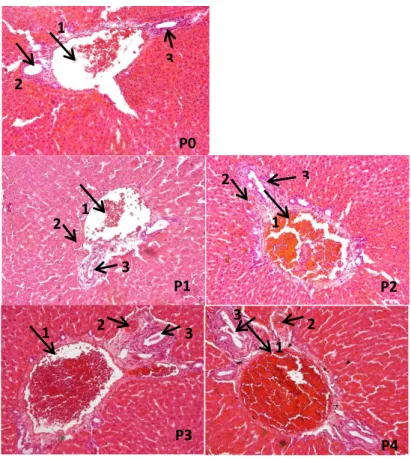 Gambar 4. Histopatologi vena sentralis hepar tikus Wistar yang mengalami stres fisiologis setelah pemberian  pakan  dengan  suplementasi  daging  ikan  gabus