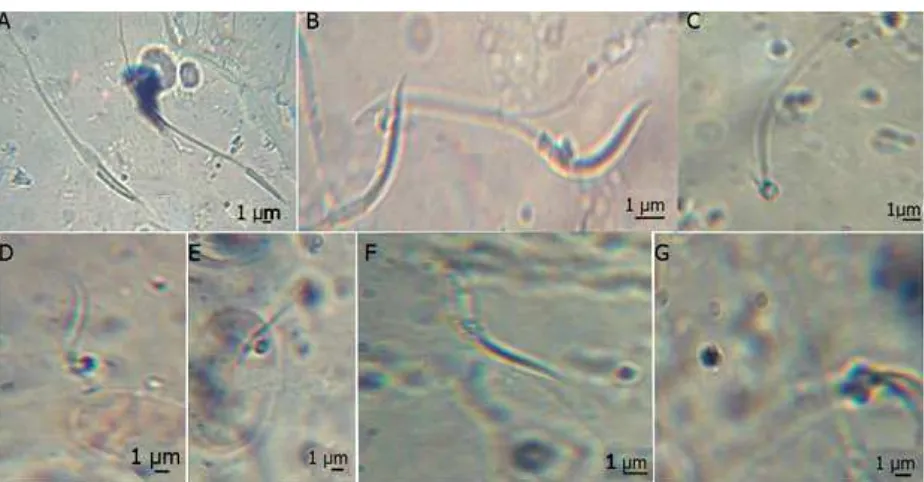 Gambar 6. Morfologi sperma abnormal I. forstenii. A. Ekor putus, B. Kepala putus, C. Ekor pendek dan ekor patah , D