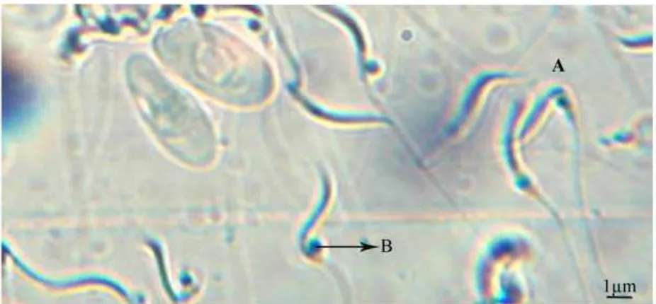 Gambar 3.Morfologi sperma I.forstenii: A. Sperma normal epididimis, B. Butiran sitoplasma pada midpiece