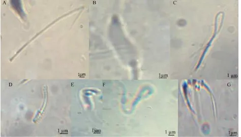 Gambar 4.Morfologi sperma abnormal C. amboinensis.A. Ekor putus, B. Makrosepalus, C. Ekor melingkar, D