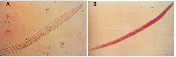 Gambar 110. Larva Rhhabditiform ((A) dan Larvva Filariformm (B) Cacingg Tambang