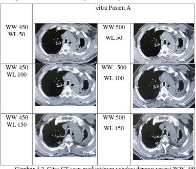 Gambar 4.2  Citra CT scan mediastinum window dengan variasi WW  450, 