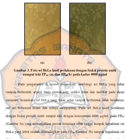 Gambar 3. Foto sel HeLa hasil perlakuan dengan fraksi protein umbi  