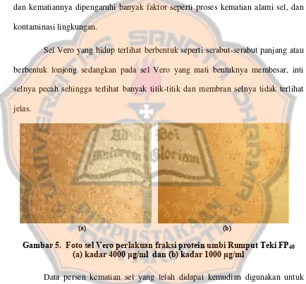 Gambar 5.  Foto sel Vero perlakuan fraksi protein umbi Rumput Teki FP40 (a) kadar 4000 μg/ml  dan (b) kadar 1000 μg/ml