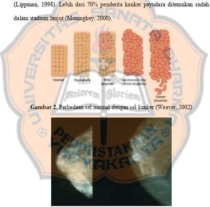 Gambar 2.  Perbedaan sel normal dengan sel kanker (Weaver, 2002) 