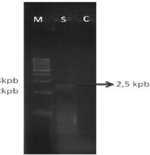 Gambar 4. Amplifikasi dengan metode LPCR. Lajur pertama (M) adalah petanda DNA 1 kpb. Lajur kedua (S) adalah sampel yang mengandung genom HBV yang diperbanyak