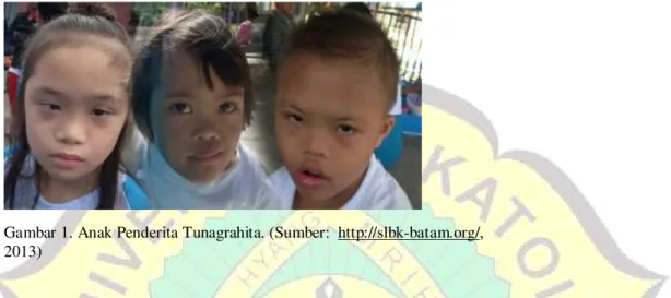 Gambar 1. Anak Penderita Tunagrahita. (Sumber:  http://slbk-batam.org/,  2013) 