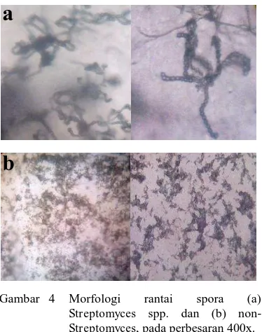 Gambar 4 Morfologi Streptomyces 