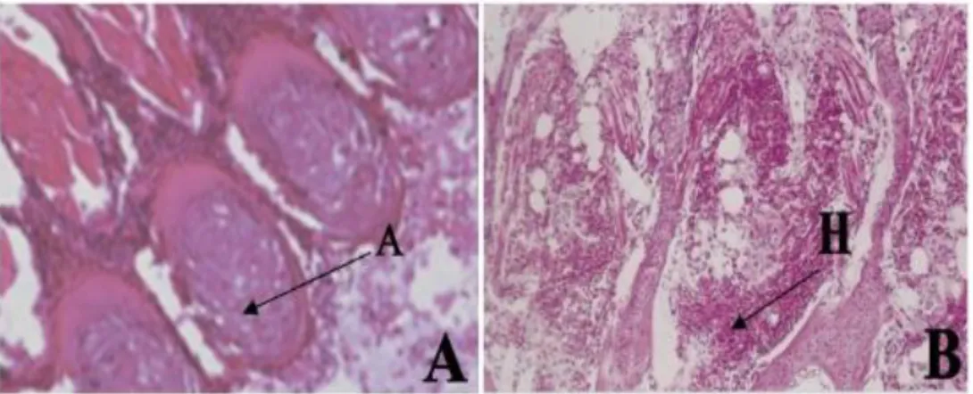 Gambar 7. Patologi arcus insang ikan lele dumbo dumbo (C. gariepinus) dengan                   pewarnaan  H-E  (A