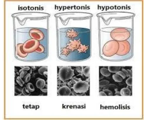 Gambar  13.  Proses Krenasi dan Hemolisis pada Sel Darah Merah Sumber : http://biologigonz.blogspot.co.id/2010/02/krenasi-plasmolisis.html 