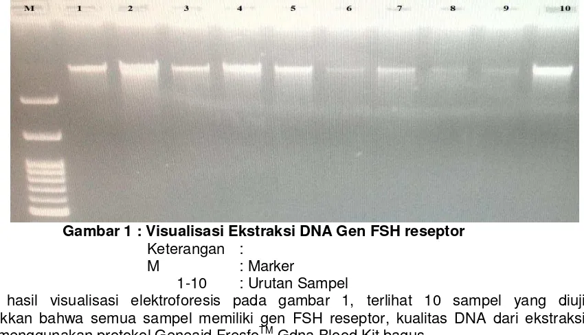 Gambar 1 : Visualisasi Ekstraksi DNA Gen FSH reseptor 