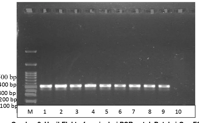 Gambar 2. Hasil Elektroforesis dari PCR untuk Deteksi Gen FSHr  