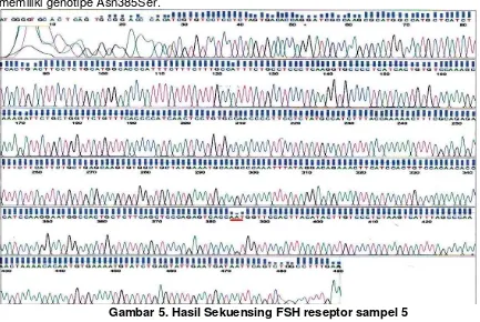 Gambar 5. Hasil Sekuensing FSH reseptor sampel 5 