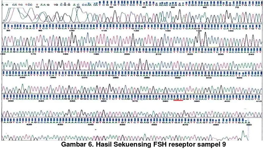 Gambar 6. Hasil Sekuensing FSH reseptor sampel 9 