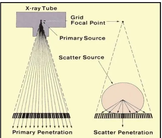 Gambar 2.12 Prinsip Kerja Grid (Sprawls, 2010) 
