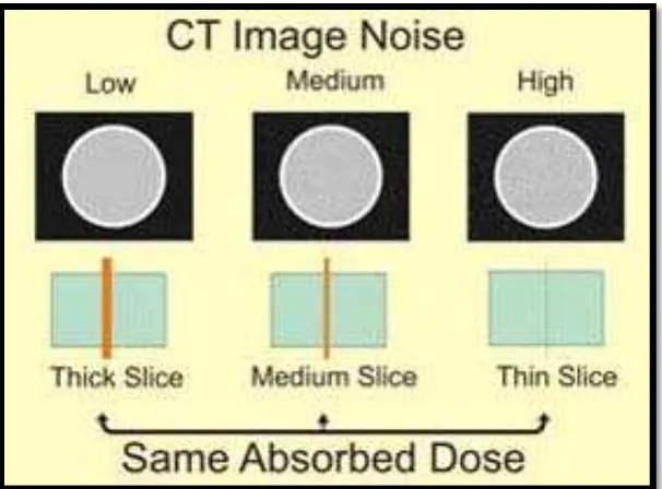 Gambar 2.5. Perbedaan Citra Noise Berdasarkan Slice Thickness  (Sprawls, 1995) 
