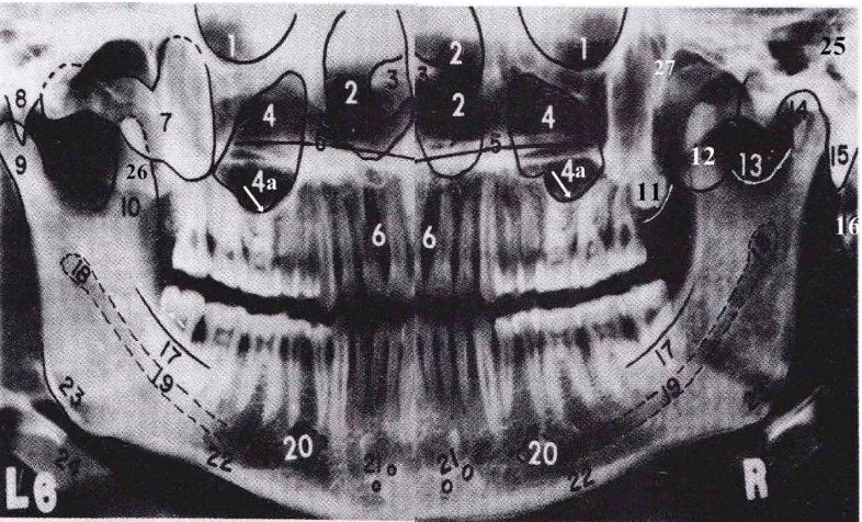 Gambar 1. Struktur anatomi pada radiografi panoramik2 
