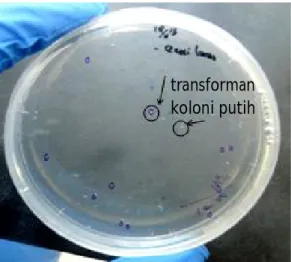 Figure  2. E. coli TOP 10 colonies formed after transformed on TOPO TA Cloning