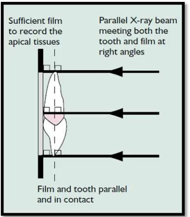 Gambar 6. Posisi film, gigi dan sumber cahaya pada teknik paralleling26  