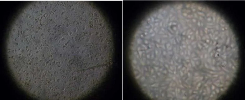 Gambar morfologi sel kanker serviks HeLa dan Vero (dilihat dengan mikroskop inverted dengan perbesaran 10x10) setelah pemberian ekstrak dari konsentrasi tertinggi hingga terendah 